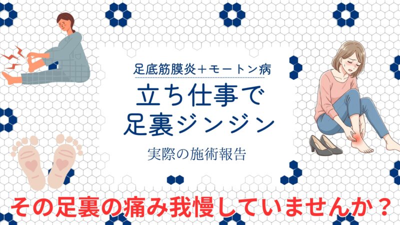 立ち仕事足裏痛い女性